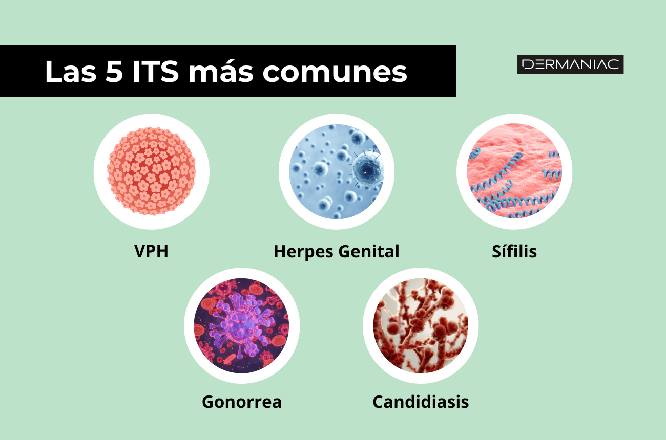 Infecciones de transmisión sexual (ITS) en chile